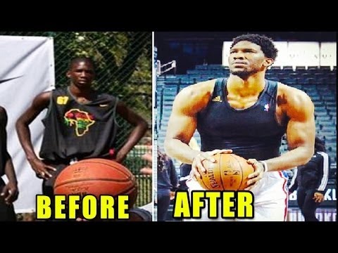 Embiid Before and After